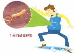 揪出你胃里的隐藏杀手，幽门螺旋杆菌！